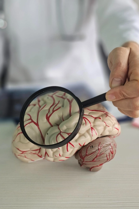 нарушение мозгового кровообращения при инсульте